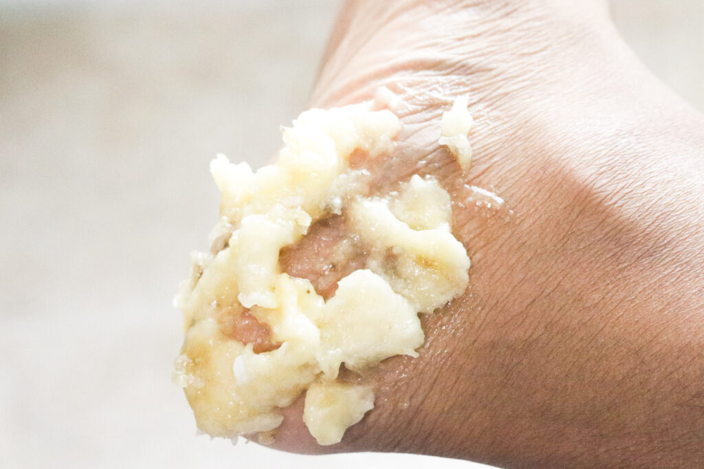 applying banana and coconut oil paste to heels for home remedies for cracked heels